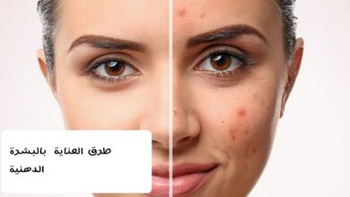 طرق العناية بالبشرة الدهنية