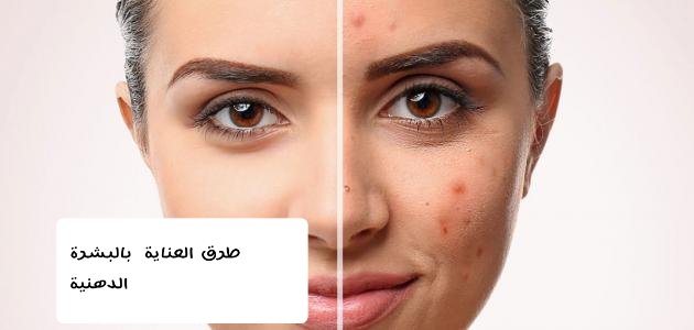 طرق العناية بالبشرة الدهنية